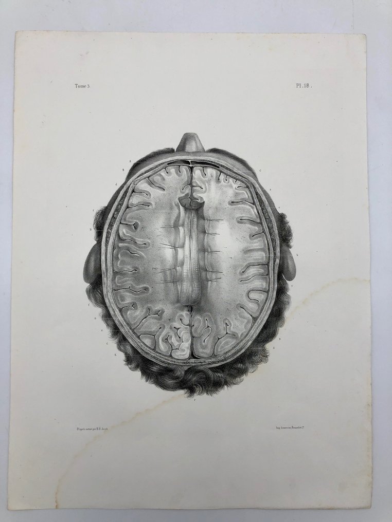 Matériel pédagogique (3) - Nicolas-Henri Jacob & Jean Baptiste Marc Bourgery - traité d'anatomie de l'homme 1881 - Papier - 1850-1900 #1.2