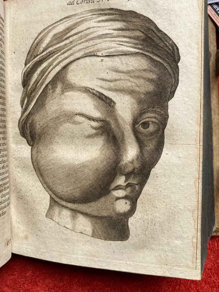 GOCKEL (Eberhard). - [Plague and Pathology]: Gallicinium medico-practicum. Sive consiliorum, observationum medicinalium - 1700 #4.3