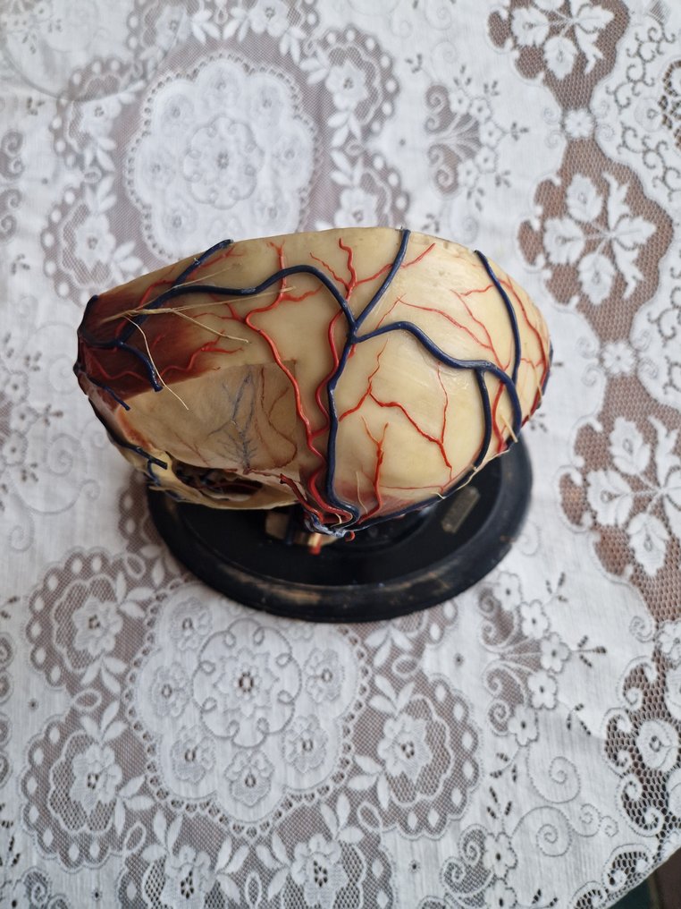 Modello anatomico -  - 1930-1940 - Modello anatomico in cera di un cranio - A & P Seifert #4.3