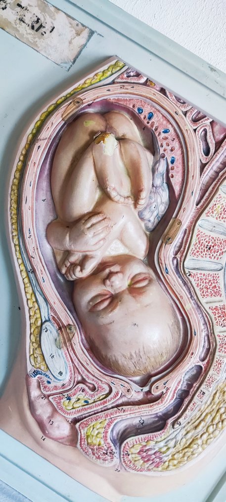 Model anatomic - material plastic - 1950-1960 - Placă educațională despre sarcină #3.2