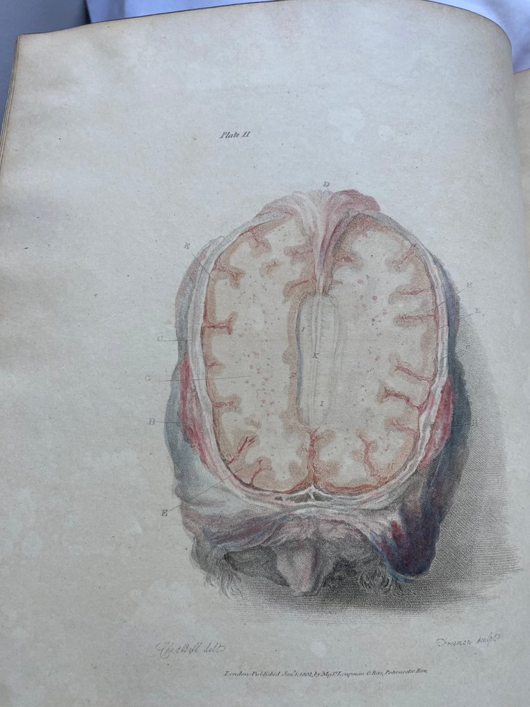 Sir Charles Bell - The Anatomy of the Brain, Explained in a Series of Engravings. - 1802 #2.1