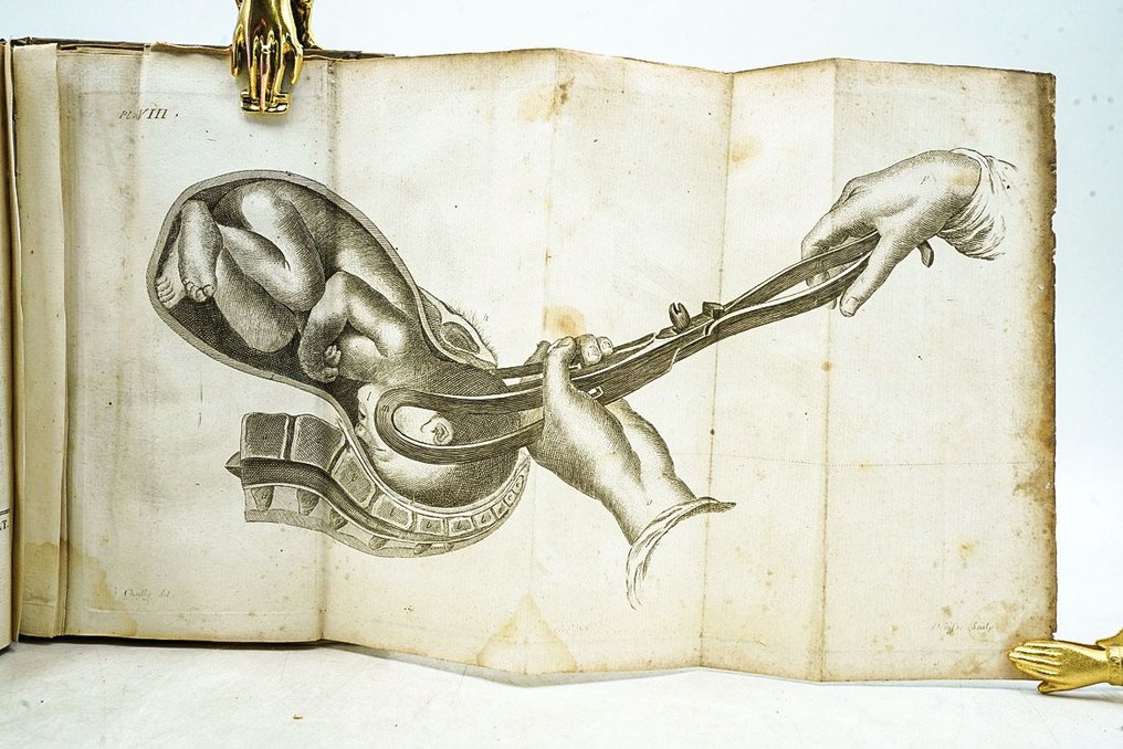 Jean-Louis Baudelocque - L'art des accouchemens - 1796-1807 #3.2