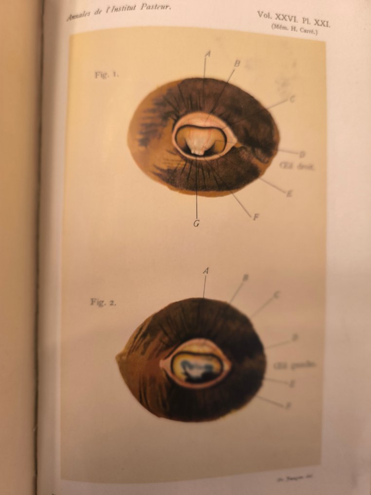 A .Calmette et G.Guerin - Recherche expérimental sur la défense de l'organisme contre l'infection tuberculose dans Annales de - 1910-1912 #1.0