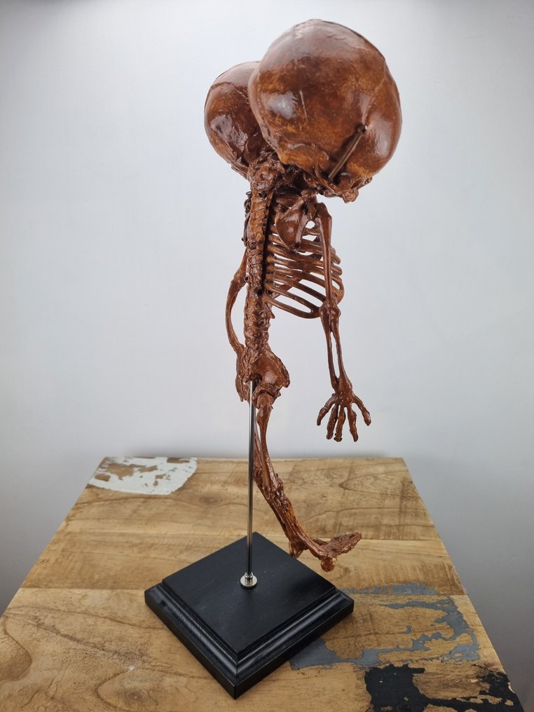 Αντίγραφο: Εμβρυϊκός σκελετός Siamese με δύο κεφάλια. Βάση ρεπλίκας ταρίχευσης - - - 38 cm - 14 cm - 11 cm - 1 #3.2