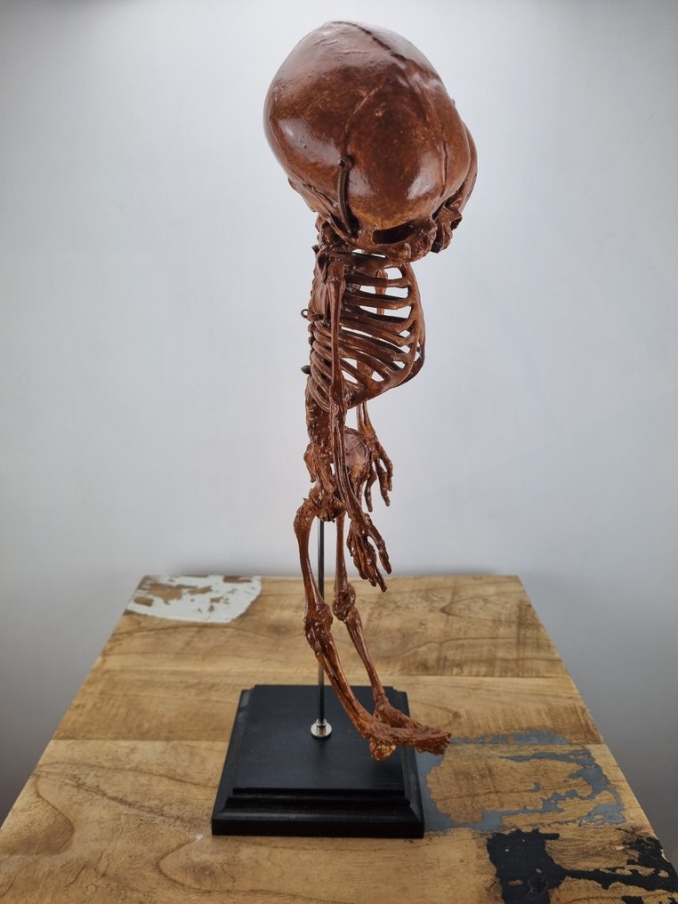 Αντίγραφο: Εμβρυϊκός σκελετός Siamese με δύο κεφάλια. Βάση ρεπλίκας ταρίχευσης - - - 38 cm - 14 cm - 11 cm - 1 #2.1