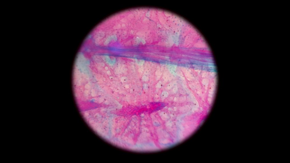 Peristedion Carapace - Peristedion amblygenys - 15 cm - 3 cm - 3 cm - Espèces non-CITES - 1 #3.2